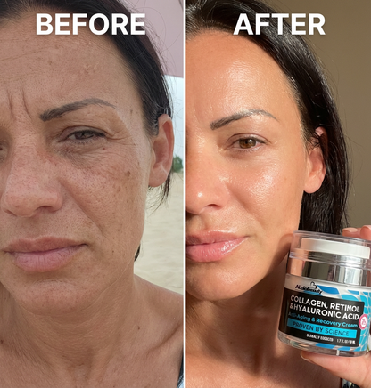 ALAIA-Anti-Age Крем за лице и шия - запълва дълбоките бръчки с повдигащ ефект !!!